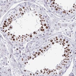 TCF-3/E2A Antibody, Novus Biologicals:Antibodies:Primary Antibodies