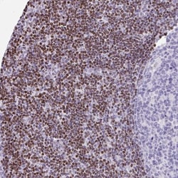 TCF-3/E2A Antibody, Novus Biologicals:Antibodies:Primary Antibodies