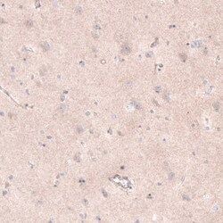 TCF21 Antibody, Novus Biologicals 0.1mL; Unlabeled:Antibodies, Polyclonal