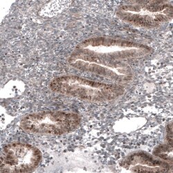 TCF21 Antibody, Novus Biologicals 0.1mL; Unlabeled:Antibodies, Polyclonal