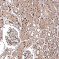 TCF21 Antibody, Novus Biologicals 0.1mL; Unlabeled:Antibodies, Polyclonal