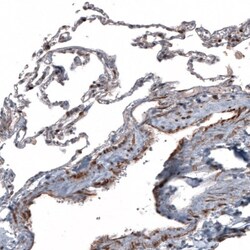 TCF21 Antibody, Novus Biologicals 0.1mL; Unlabeled:Antibodies, Polyclonal