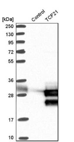 TCF21 Antibody, Novus Biologicals 0.1mL; Unlabeled:Antibodies, Polyclonal