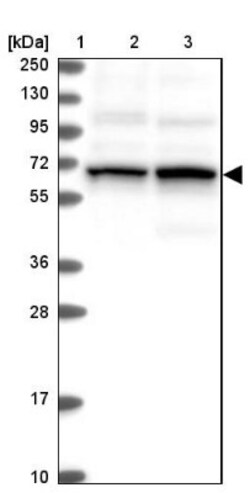 TCHP Antibody, Novus Biologicals 0.1mL; Unlabeled:Antibodies, Polyclonal