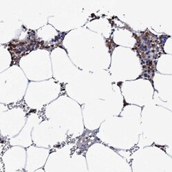 TCIRG1 Antibody, Novus Biologicals 0.1mL; Unlabeled:Antibodies, Polyclonal