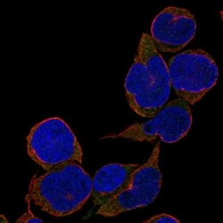 TCL1B Antibody, Novus Biologicals 0.1mL; Unlabeled:Antibodies, Polyclonal