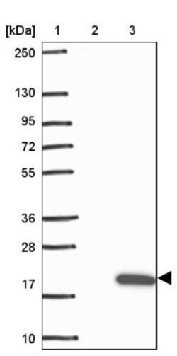 TCL1B Antibody, Novus Biologicals 0.1mL; Unlabeled:Antibodies, Polyclonal