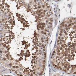 TCP1-beta Antibody, Novus Biologicals:Antibodies:Primary Antibodies