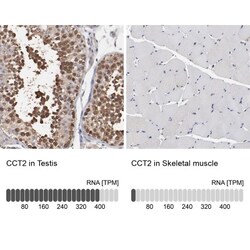 TCP1-beta Antibody, Novus Biologicals:Antibodies:Primary Antibodies