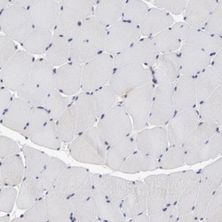 TCP1-beta Antibody, Novus Biologicals:Antibodies:Primary Antibodies