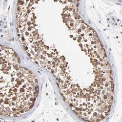 TCP1-beta Antibody, Novus Biologicals:Antibodies:Primary Antibodies