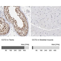 TCP1-beta Antibody, Novus Biologicals:Antibodies:Primary Antibodies