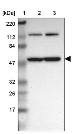 TCP1-beta Antibody, Novus Biologicals:Antibodies:Primary Antibodies