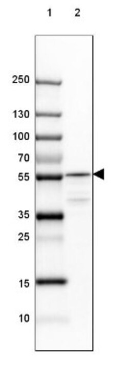 TCP1-beta Antibody, Novus Biologicals:Antibodies:Primary Antibodies