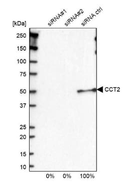 TCP1-beta Antibody, Novus Biologicals:Antibodies:Primary Antibodies