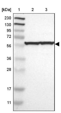 TCP1-eta Antibody, Novus Biologicals 25 &mu;L; Unlabeled:Antibodies, Polyclonal