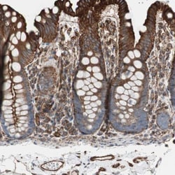 Cytokeratin 10 Antibody, Novus Biologicals:Antibodies:Primary Antibodies