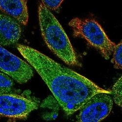 TCTEX1D2 Antibody, Novus Biologicals 25 &mu;L, Unlabeled:Antibodies, Polyclonal