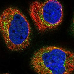 TCTN2 Antibody, Novus Biologicals 0.1mL; Unlabeled:Antibodies, Polyclonal