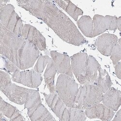 TCTN2 Antibody, Novus Biologicals 0.1mL; Unlabeled:Antibodies, Polyclonal