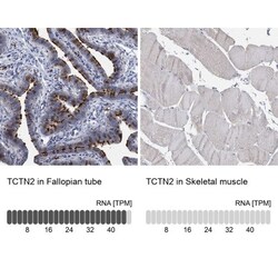 TCTN2 Antibody, Novus Biologicals 0.1mL; Unlabeled:Antibodies, Polyclonal