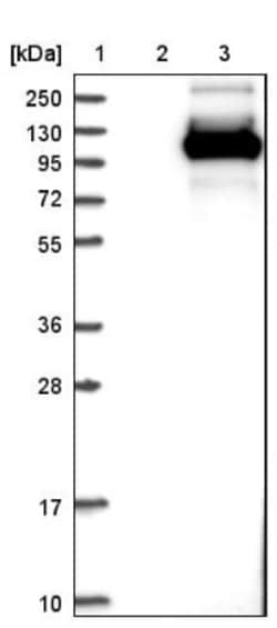 TCTN2 Antibody, Novus Biologicals 0.1mL; Unlabeled:Antibodies, Polyclonal