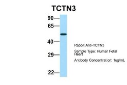 TCTN3 Antibody, Novus Biologicals:Antibodies:Primary Antibodies