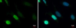 TDG Antibody, Novus Biologicals 0.1mL; Unlabeled:Antibodies, Polyclonal