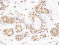 TDG Antibody, Novus Biologicals 0.1mg; Unlabeled:Antibodies, Polyclonal
