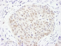 TDG Antibody, Novus Biologicals 0.1mg; Unlabeled:Antibodies, Polyclonal