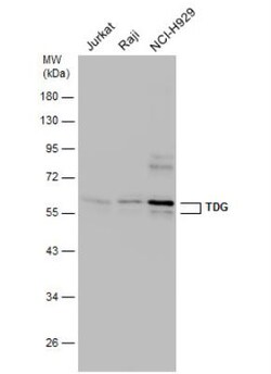 TDG Antibody, Novus Biologicals 0.1mL; Unlabeled:Antibodies, Polyclonal