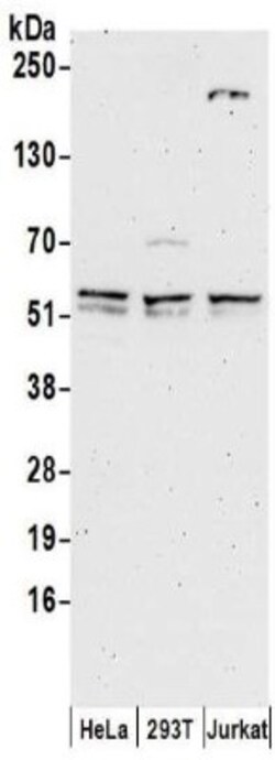 TDG Antibody, Novus Biologicals 0.1mg; Unlabeled:Antibodies, Polyclonal