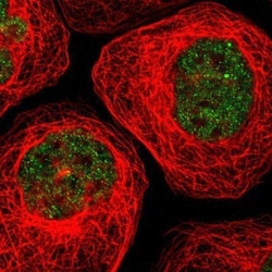 TDP-43/TARDBP Antibody, Novus Biologicals:Antibodies:Primary Antibodies