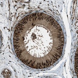 TDP-43/TARDBP Antibody, Novus Biologicals:Antibodies:Primary Antibodies