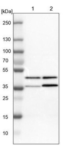TDP-43/TARDBP Antibody, Novus Biologicals:Antibodies:Primary Antibodies