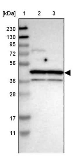 TDP-43/TARDBP Antibody, Novus Biologicals:Antibodies:Primary Antibodies