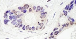 TDP1 Antibody, Novus Biologicals 0.1mL; Unlabeled:Antibodies, Polyclonal