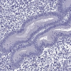 TDRD1 Antibody, Novus Biologicals:Antibodies:Primary Antibodies