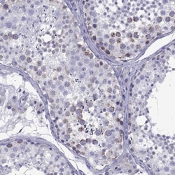 TDRD1 Antibody, Novus Biologicals:Antibodies:Primary Antibodies