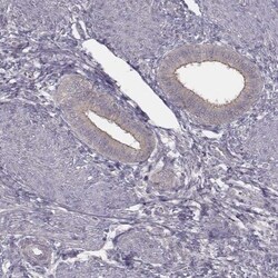 TDRD5 Antibody, Novus Biologicals 25 &mu;L; Unlabeled:Antibodies, Polyclonal