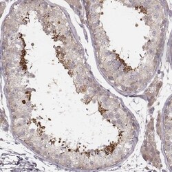 TDRD5 Antibody, Novus Biologicals 25 &mu;L; Unlabeled:Antibodies, Polyclonal