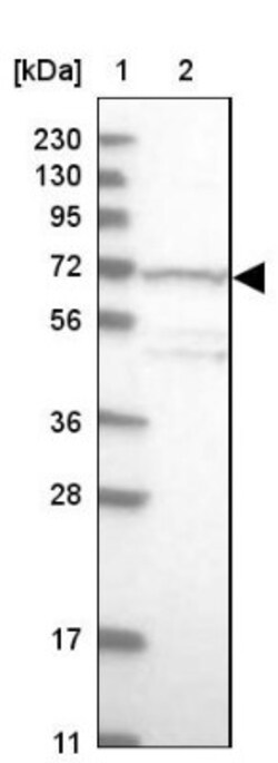 TDRKH Antibody, Novus Biologicals 0.1mL; Unlabeled:Antibodies, Polyclonal