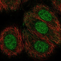 TECPR2 Antibody, Novus Biologicals 0.1mL; Unlabeled:Antibodies, Polyclonal