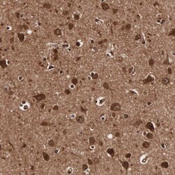 TECPR2 Antibody, Novus Biologicals 0.1mL; Unlabeled:Antibodies, Polyclonal