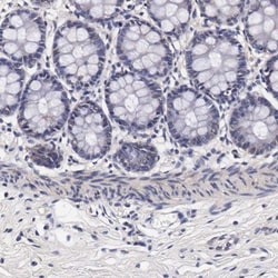 TECPR2 Antibody, Novus Biologicals 0.1mL; Unlabeled:Antibodies, Polyclonal