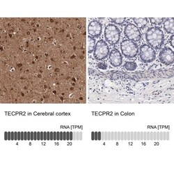 TECPR2 Antibody, Novus Biologicals 0.1mL; Unlabeled:Antibodies, Polyclonal