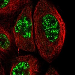 TEM Antibody, Novus Biologicals 0.1mL; Unlabeled:Antibodies, Polyclonal