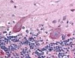 TEM7/PLXDC1 Antibody (197C193 (IM193)) - BSA Free, Novus Biologicals 0.1mg;