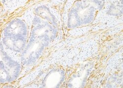 TEM8/ANTXR1 Antibody (200C1339(SB20)) - Azide and BSA Free, Novus Biologicals