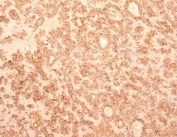 TEM8/ANTXR1 Antibody (200C1339(SB20)) - Azide and BSA Free, Novus Biologicals